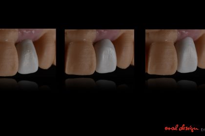 Het verschil zit hem in de details!